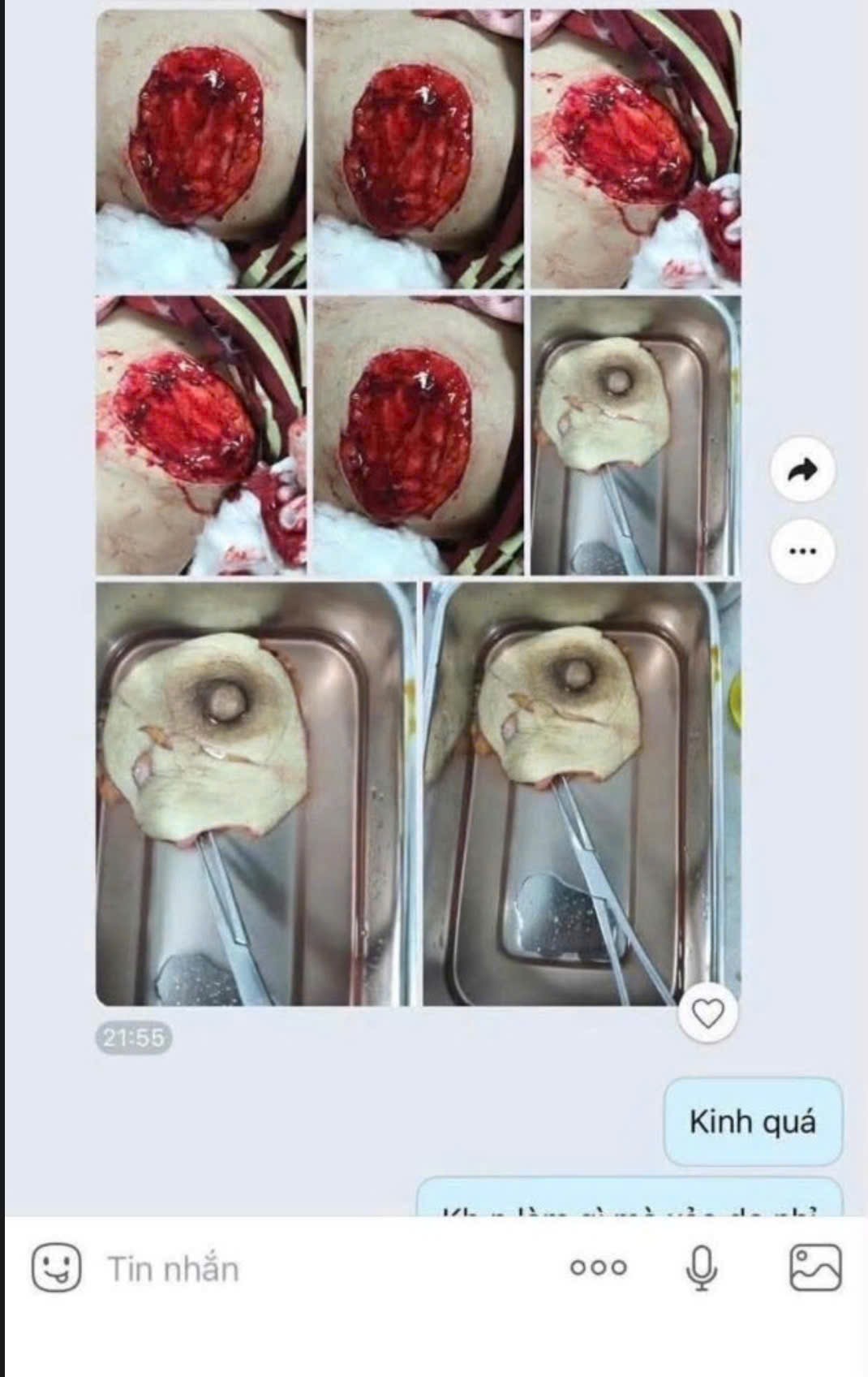 1000051276